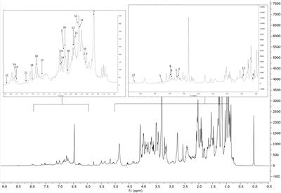 Targeted metabolite profiling of Salvia rosmarinus Italian local ecotypes and cultivars and inhibitory activity against Pectobacterium carotovorum subsp. carotovorum